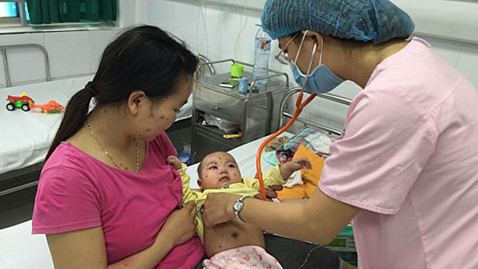   Tăng cường công tác phòng, chống bệnh sởi trên địa bàn tỉnh